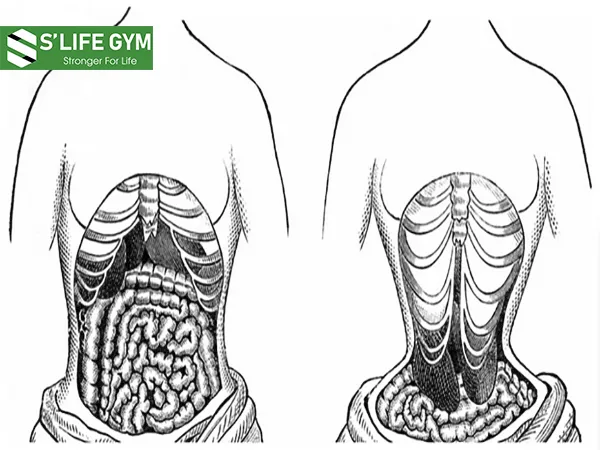 Gen nịt bụng gây chèn ép các cơ quan tiêu hóa