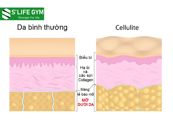 Các bài tập loại bỏ da sần vỏ cam sẽ giúp bạn lấy lại vóc dáng săn chắc